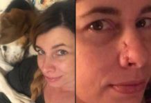 Dog Saves Her Owner’s Life After Detecting A Horrible Disease On Her Nose