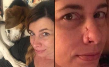 Dog Saves Her Owner’s Life After Detecting A Horrible Disease On Her Nose